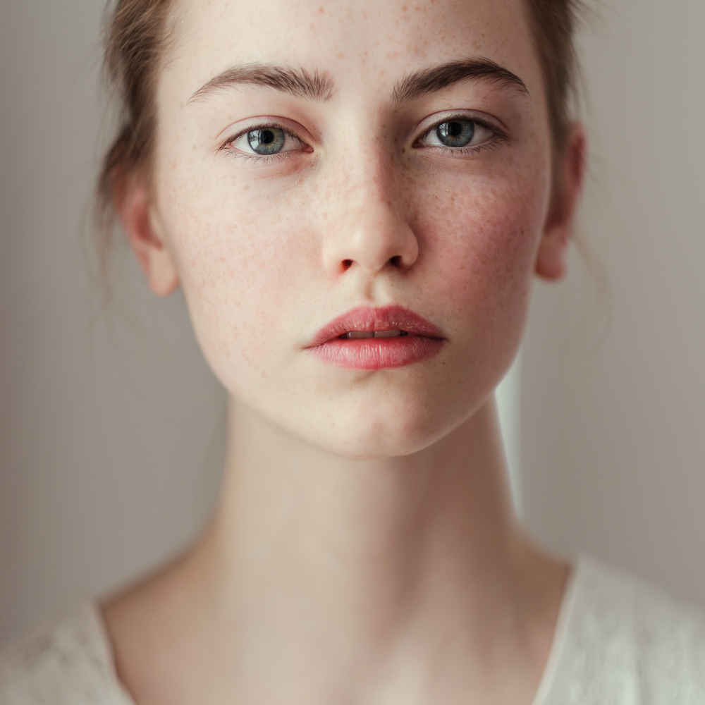 Morning,Portrait,Of,A,Beautiful,Young,Girl,With,Freckles